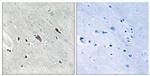 Phospho-GAB2 (Tyr643) Antibody in Immunohistochemistry (Paraffin) (IHC (P))