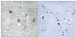 Phospho-TOB1 (Ser164) Antibody in Immunohistochemistry (Paraffin) (IHC (P))