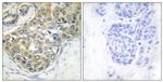 Phospho-ACK1 (Tyr284) Antibody in Immunohistochemistry (Paraffin) (IHC (P))