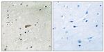 Phospho-FRS2 (Tyr436) Antibody in Immunohistochemistry (Paraffin) (IHC (P))