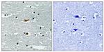 Phospho-STK39 (Ser309) Antibody in Immunohistochemistry (Paraffin) (IHC (P))