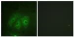 Phospho-p47phox (Ser359) Antibody in Immunocytochemistry (ICC/IF)