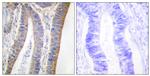 Phospho-p47phox (Ser359) Antibody in Immunohistochemistry (Paraffin) (IHC (P))