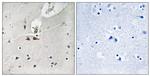 Phospho-Ephrin B1/B2/B3 (Tyr324/311/318) Antibody in Immunohistochemistry (Paraffin) (IHC (P))