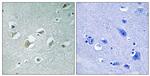 Phospho-MLK1/MLK2 (Thr312, Thr266) Antibody in Immunohistochemistry (Paraffin) (IHC (P))