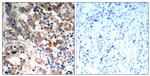 Phospho-AMPK alpha-1,2 (Thr172) Antibody in Immunohistochemistry (Paraffin) (IHC (P))