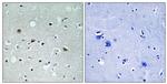 Phospho-LATS1/LATS2 (Thr1079, Thr1041) Antibody in Immunohistochemistry (Paraffin) (IHC (P))