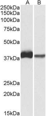 CAPG Antibody in Western Blot (WB)