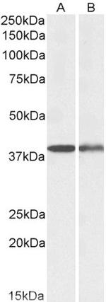 CAPG Antibody in Western Blot (WB)