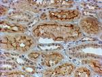 COL4A3 Antibody in Immunohistochemistry (Paraffin) (IHC (P))