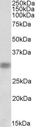 CRX Antibody in Western Blot (WB)