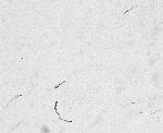 FGF14 Antibody in Immunohistochemistry (PFA fixed) (IHC (PFA))