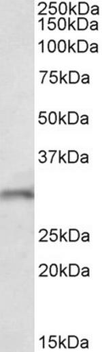 FGF14 Antibody in Western Blot (WB)