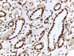 ILF3 Antibody in Immunohistochemistry (Paraffin) (IHC (P))