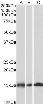 NDUFA7 Antibody in Western Blot (WB)