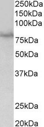 SIM1 Antibody in Western Blot (WB)