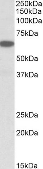 PLA2G4C Antibody in Western Blot (WB)