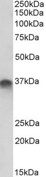 STX11 Antibody in Western Blot (WB)