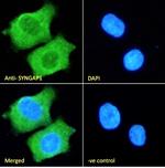 SynGAP Antibody in Immunocytochemistry (ICC/IF)