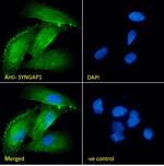 SynGAP Antibody in Immunocytochemistry (ICC/IF)