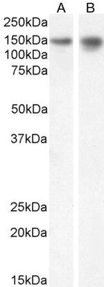 SynGAP Antibody in Western Blot (WB)