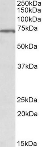 MLC1 Antibody in Western Blot (WB)