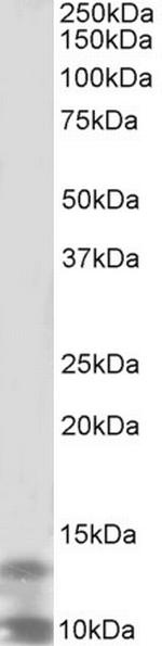 DPM3 Antibody in Western Blot (WB)