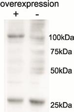 AARS2 Antibody in Western Blot (WB)