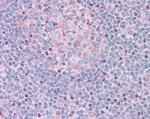 CTDSP1 Antibody in Immunohistochemistry (Paraffin) (IHC (P))