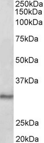 CTDSP1 Antibody in Western Blot (WB)