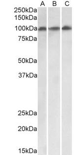 VPS16 Isoform 1 Antibody in Western Blot (WB)