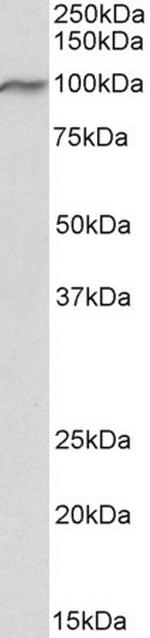 VPS16 Isoform 1 Antibody in Western Blot (WB)