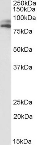 VPS16 Antibody in Western Blot (WB)