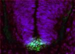 FERD3L Antibody in Immunohistochemistry (PFA fixed) (IHC (PFA))