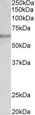 SLC47A2 Antibody in Western Blot (WB)