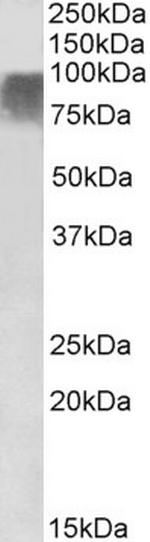 PRDM9 Antibody in Western Blot (WB)