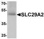 ENT2 Antibody in Western Blot (WB)