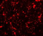 ME2 Antibody in Immunohistochemistry (Paraffin) (IHC (P))