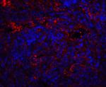 QSOX1 Antibody in Immunohistochemistry (IHC)