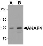 AKAP4 Antibody in Western Blot (WB)