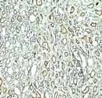 Rubicon Antibody in Immunohistochemistry (Paraffin) (IHC (P))