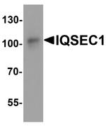 IQSEC1 Antibody in Western Blot (WB)