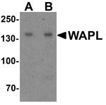 WAPL Antibody in Western Blot (WB)