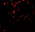 BAMBI Antibody in Immunohistochemistry (Paraffin) (IHC (P))