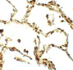 BAMBI Antibody in Immunohistochemistry (Paraffin) (IHC (P))