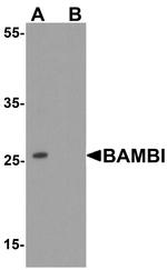 BAMBI Antibody in Western Blot (WB)