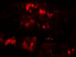 SLC29A3 Antibody in Immunohistochemistry (Paraffin) (IHC (P))