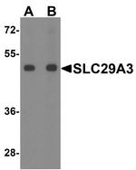 SLC29A3 Antibody in Western Blot (WB)