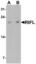 betatrophin Antibody in Western Blot (WB)