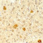 PDCL3 Antibody in Immunohistochemistry (Paraffin) (IHC (P))